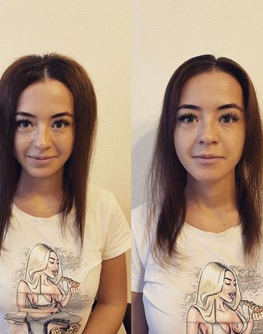 Прикорневая химия
